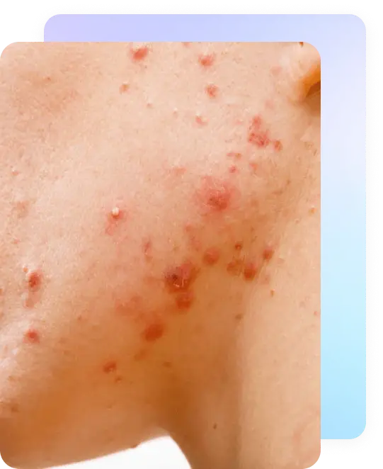 skin_trepy