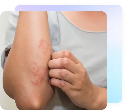 treat_Skin